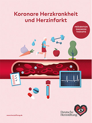 Titelbild Koronare Herzkrankheit und Herzinfarkt