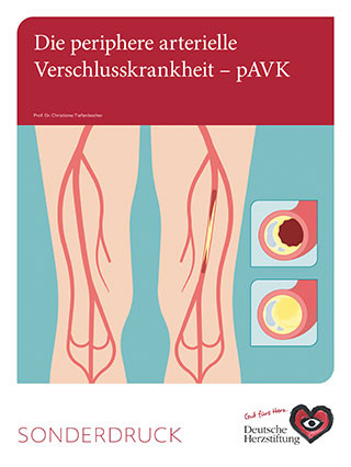 Titelbild des Sonderdrucks pAVK