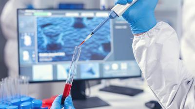 Hände die eine Blutprobe im Labor bearbeiten