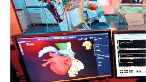 Titelbild Artikel: Katheterablation