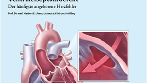 Titelbild Ventrikelseptumdefekt