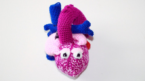 Gehäkeltes Herz mit angeborenem Herzfehler