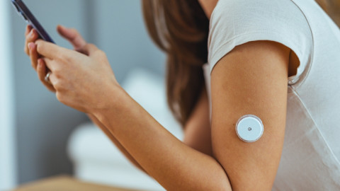 Frau misst am Arm ihren Blutzucker mit einem Sensor