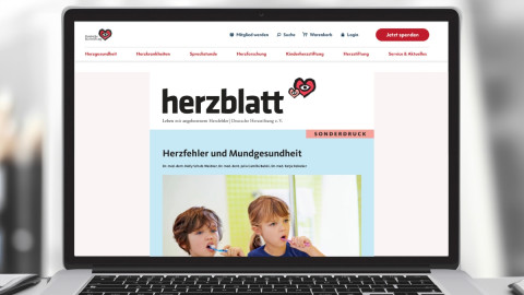 Titelbild der Broschüre "Herzfehler und Mundgesundheit" auf einem Laptopbildschirm
